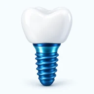 Dental implant